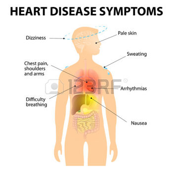 Ишемическая болезнь сердца, ишемическая болезнь сердца симптомы, ишемическая болезнь сердца лечение