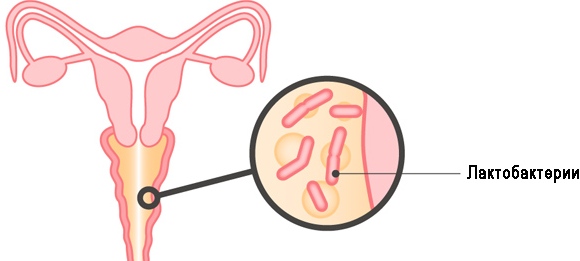 бактериальный вагиноз, бактериальный вагиноз лечение, как лечить бактериальный вагиноз