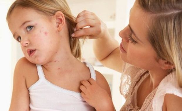 Диагностика болезней кожи у детей