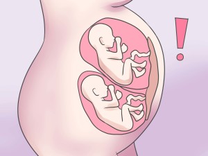 Многоплоднaя беременность - это одновременное развитие в матке 2 и более плодов. Близнецы - дети, родившиеся от многоплодной беременности.