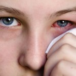 «Розовый глаз» часто является симптомом COVID-19