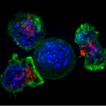 Раковые клетки вызывают воспаление, чтобы защитить себя от вирусов