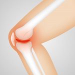 Почему люди с остеоартрозом коленного сустава испытывают разные виды боли